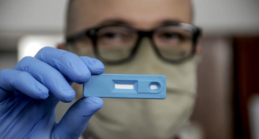 La Anmat autorizó el uso de cuatro test de autoevaluación de Covid-19