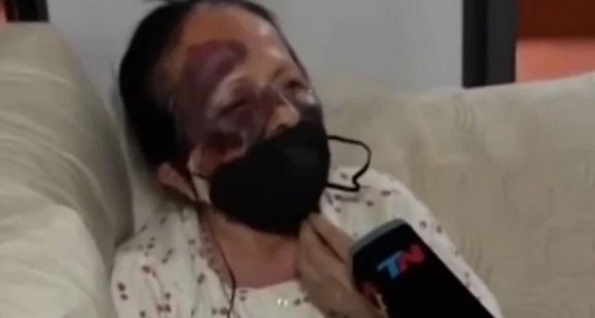 La jubilada golpeada dijo que los ladrones eran 