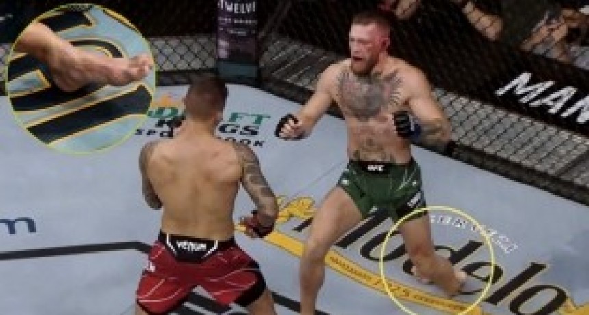 Artes marciales mixtas: Conor McGregor sufrió una impactante lesión en su pierna izquierda